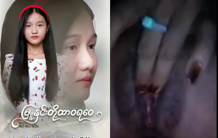 အခုနာမည်ကြီးနေတဲ့ ဆော်လေး ဘယ်သူဆိုလား အပိုင်း # 1